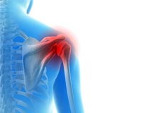 Baseball and Shoulder Injuries